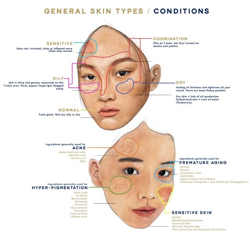 Know your skin type